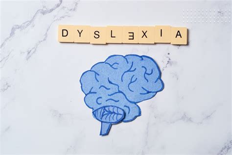 directional dyslexia|directional dyslexia in adults.